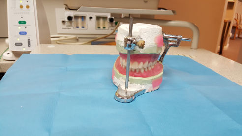 Partial or Complete Dentures